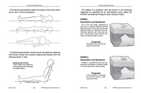 Thumbnail for Wound Care: General Principles